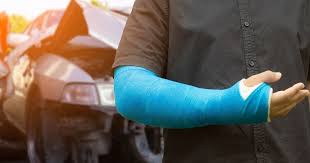 Broken Bones
